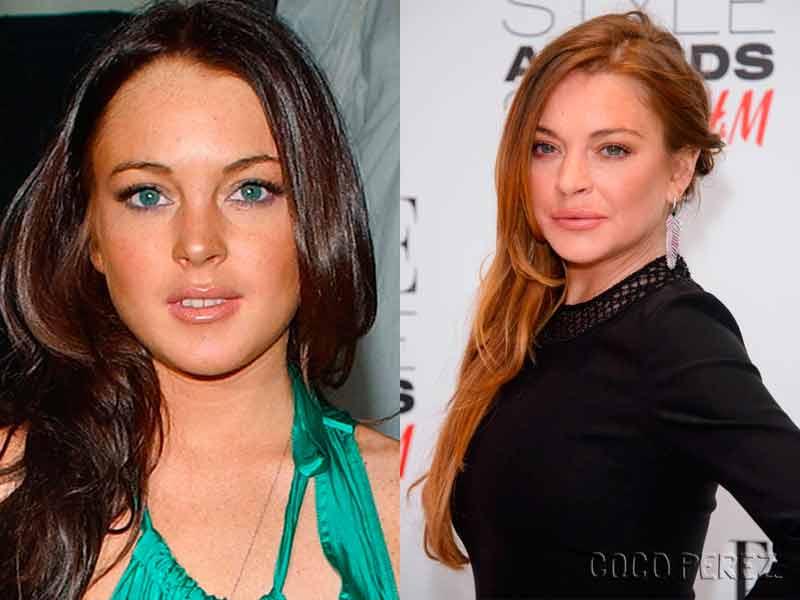 Lindsay Lohan 20 Actores Antes Y Después De Pasar Por Quirófano Álbum De Fotos