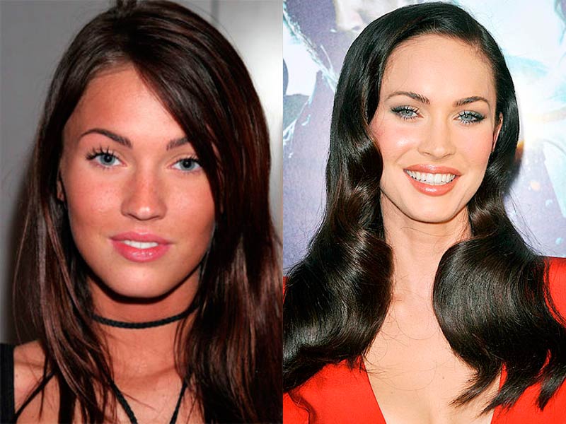 Megan Fox 20 Actores Antes Y Después De Pasar Por Quirófano Álbum