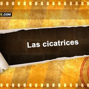 Foto Las cicatrices