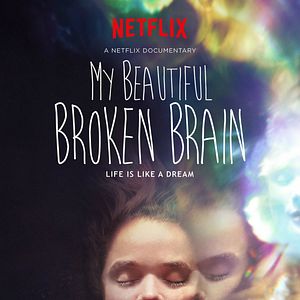 Foto My Beautiful Broken Brain