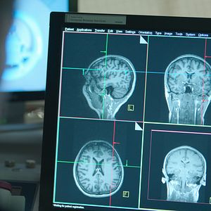 Foto Cómo cambiar tu mente