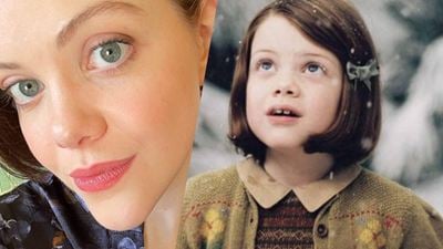 Qué fue de Georgie Henley, la niña de 'Las crónicas de Narnia': una enfermedad casi le amputa el brazo pero ahora está orgullosa de sus cicatrices