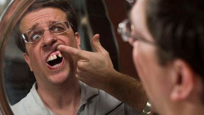 'Resacón en Las Vegas': Ed Helms realmente se quitó el diente para rodar la película noticias imagen