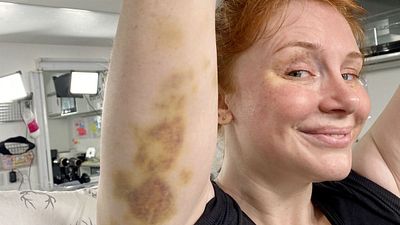 'Jurassic World: Dominion': Bryce Dallas Howard muestra el gran moratón que se ha hecho en el rodaje noticias imagen