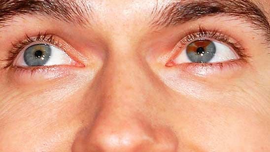 15 actores que tienen heterocromía noticias imagen