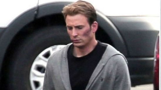 'Capitán América: Civil War': Chris Evans, lleno de moratones en las nuevas imágenes del rodaje noticias imagen