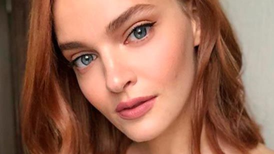 Así es la criada sin ojo de 'The Handmaid's Tale' en la vida real noticias imagen