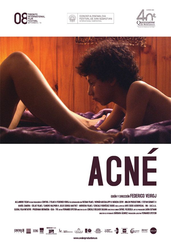 Acné - Película 2008